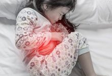 زخم های یبوست طولانی‌مدت