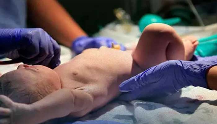 عوامل مؤثر در افزایش عوارض ختنه نوزادان