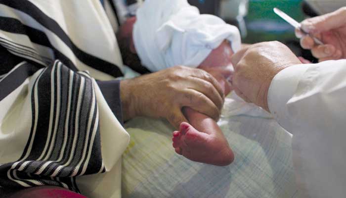 خطرات ختنه به روش سنتی