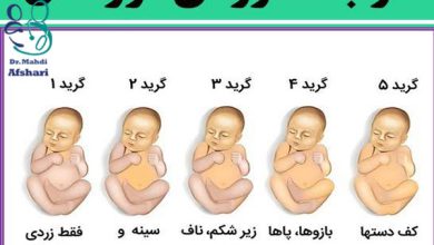 علائم خطر زردی نوزاد
