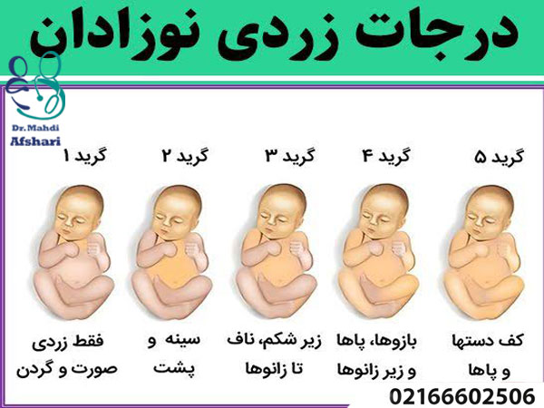 علائم خطر زردی نوزاد