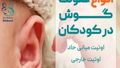 گوش درد نوزاد، علت گوش درد کودک، متخصص کودکان، متخصص اطفال