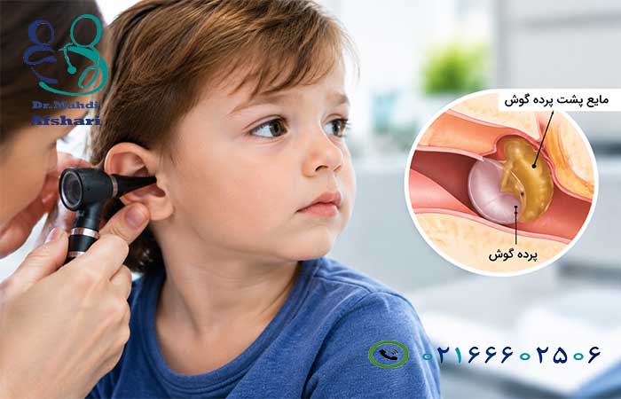 مایع پشت پرده گوش کودک